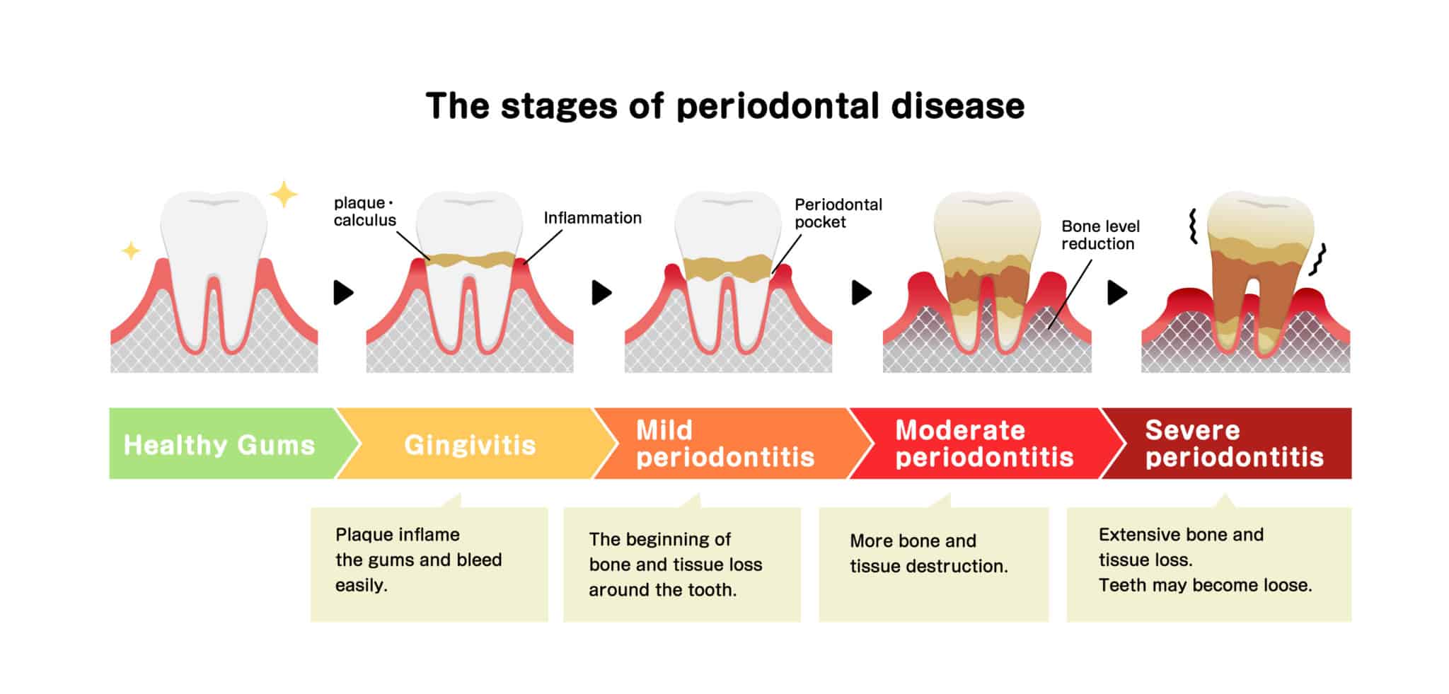 Periodontics marina dentistry