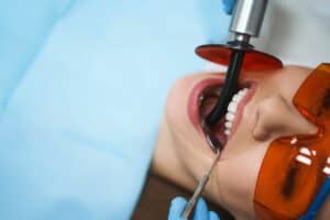 Top Questions to Ask Your Dentist