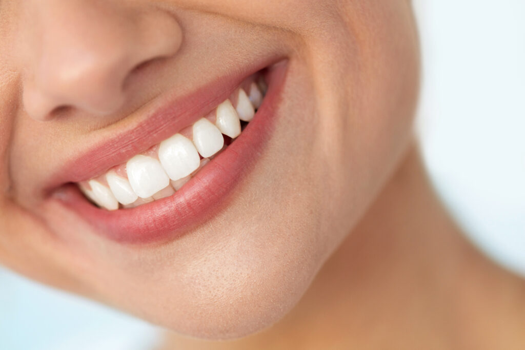 5 Things to Know Before Getting Porcelain Veneers in Westside LA