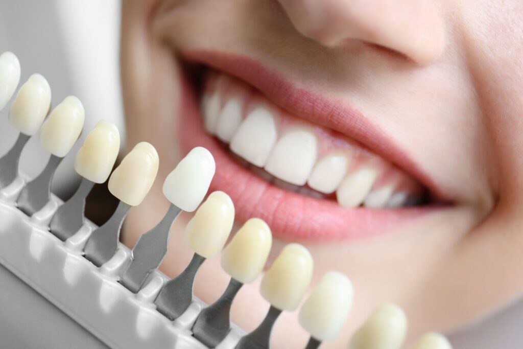 How to Choose the Right Cosmetic Dentist in Marina del Rey