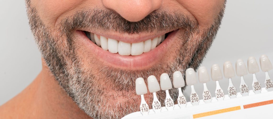 marina-denitstry-westside-los-angeles-dental-office (28)