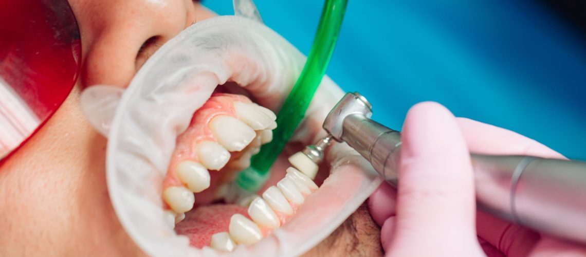 marina-denitstry-westside-los-angeles-dental-office (29)