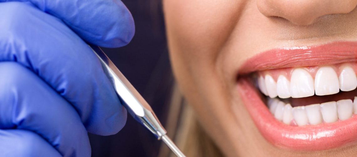 woman with healthy teeth at dentist, dental care