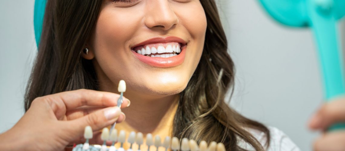 Young woman with perfect teeth , looking how white are her teeth , with teeth shade