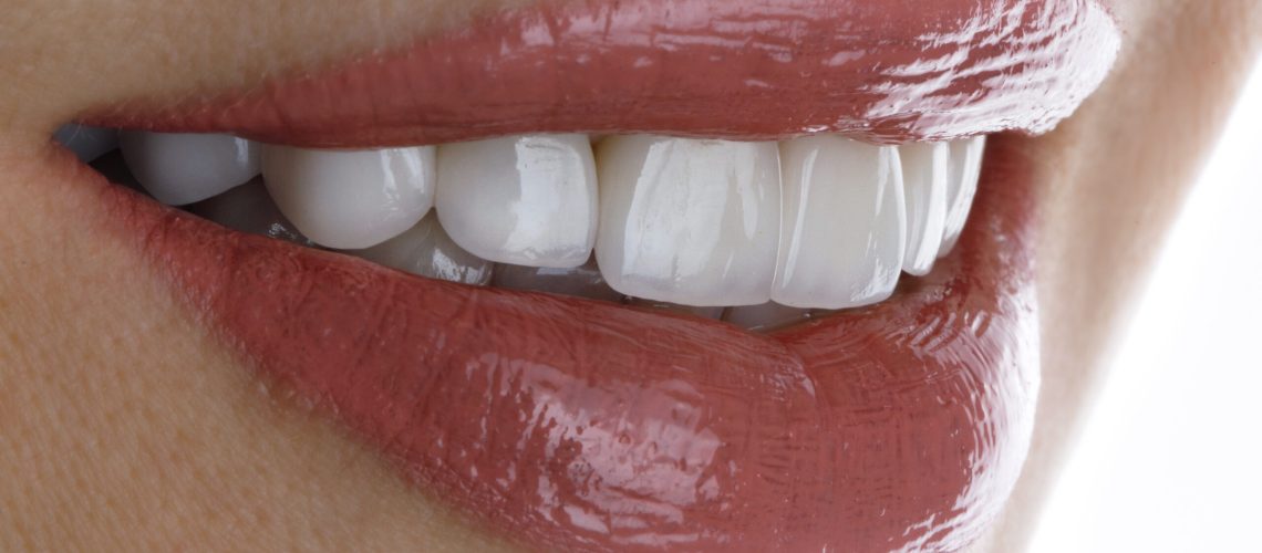 perfect smile of a girl with veneers and beautiful lipstick
